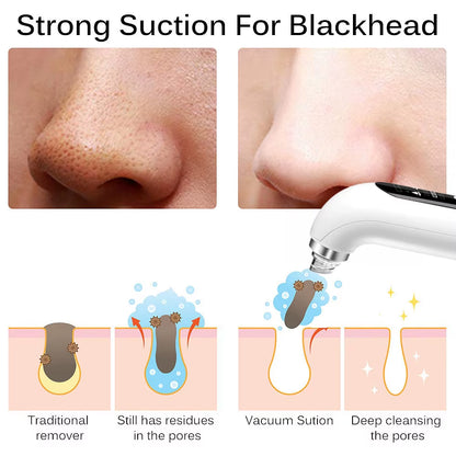 Blackhead Removal Pore Vacuum Face Cleaner Electric Pimple Black Head Remover USB Rechargeable Water Cycle Facial Cleaning Tools